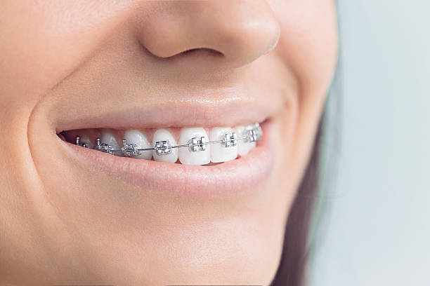 Best Wisdom Tooth Removal  in Orida Ridge, FL